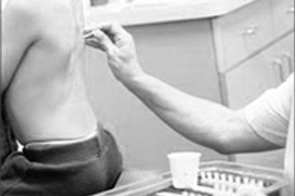 Allergietestung auf der Haut – Allergologie